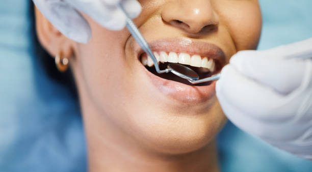 Best Emergency Wisdom Tooth Extraction in Hyde Park, UT